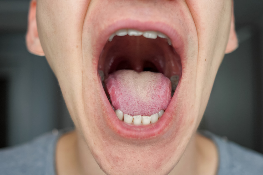 Your Tongue Can You about Your Overall Health - Rockland Specialists