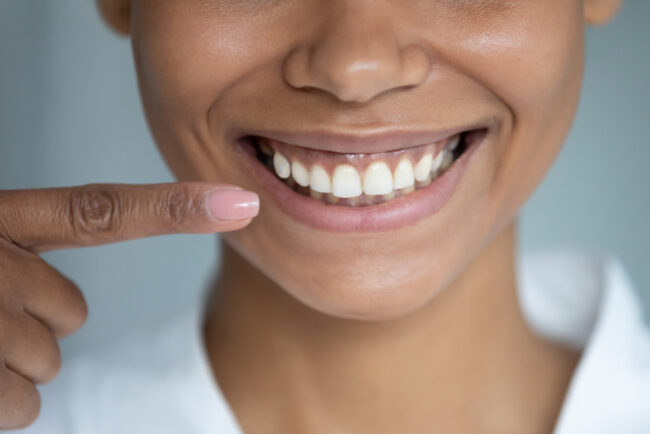 maintaining-healthy-gum-graft
