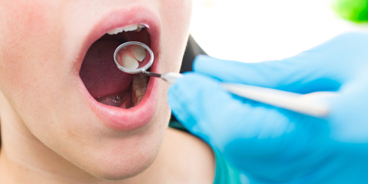 dentist looking at the mouth with tools and mirror dentist looking at the mouth with tools and mirror