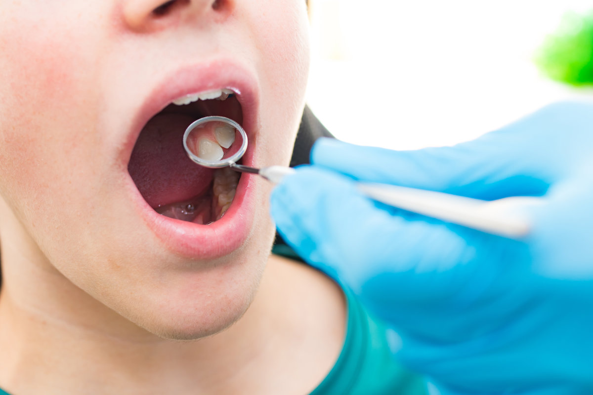 dentist looking at the mouth with tools and mirror dentist looking at the mouth with tools and mirror