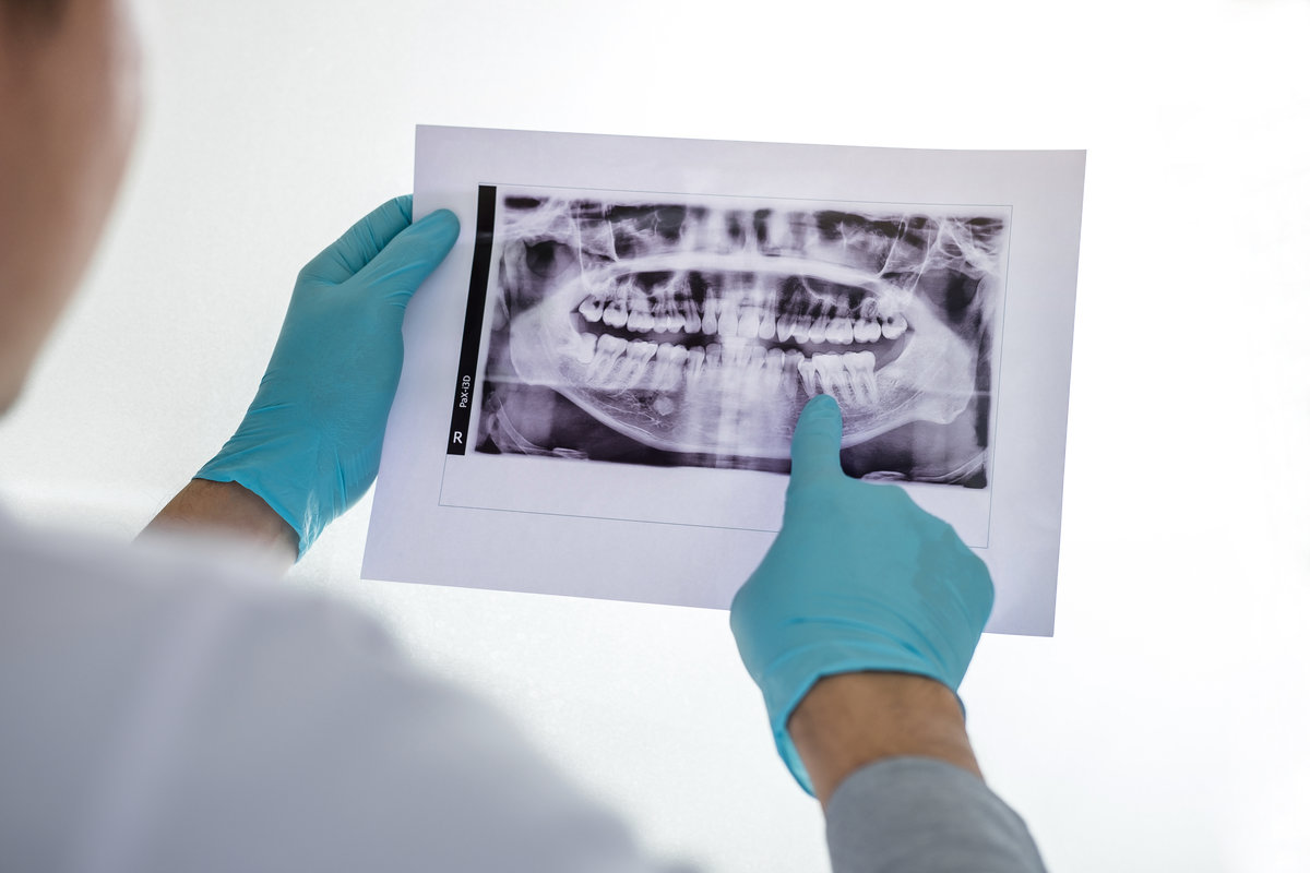 Image of male doctor or dentist holding and looking at dental x-ray Image of male doctor or dentist holding and looking at dental x-ray.