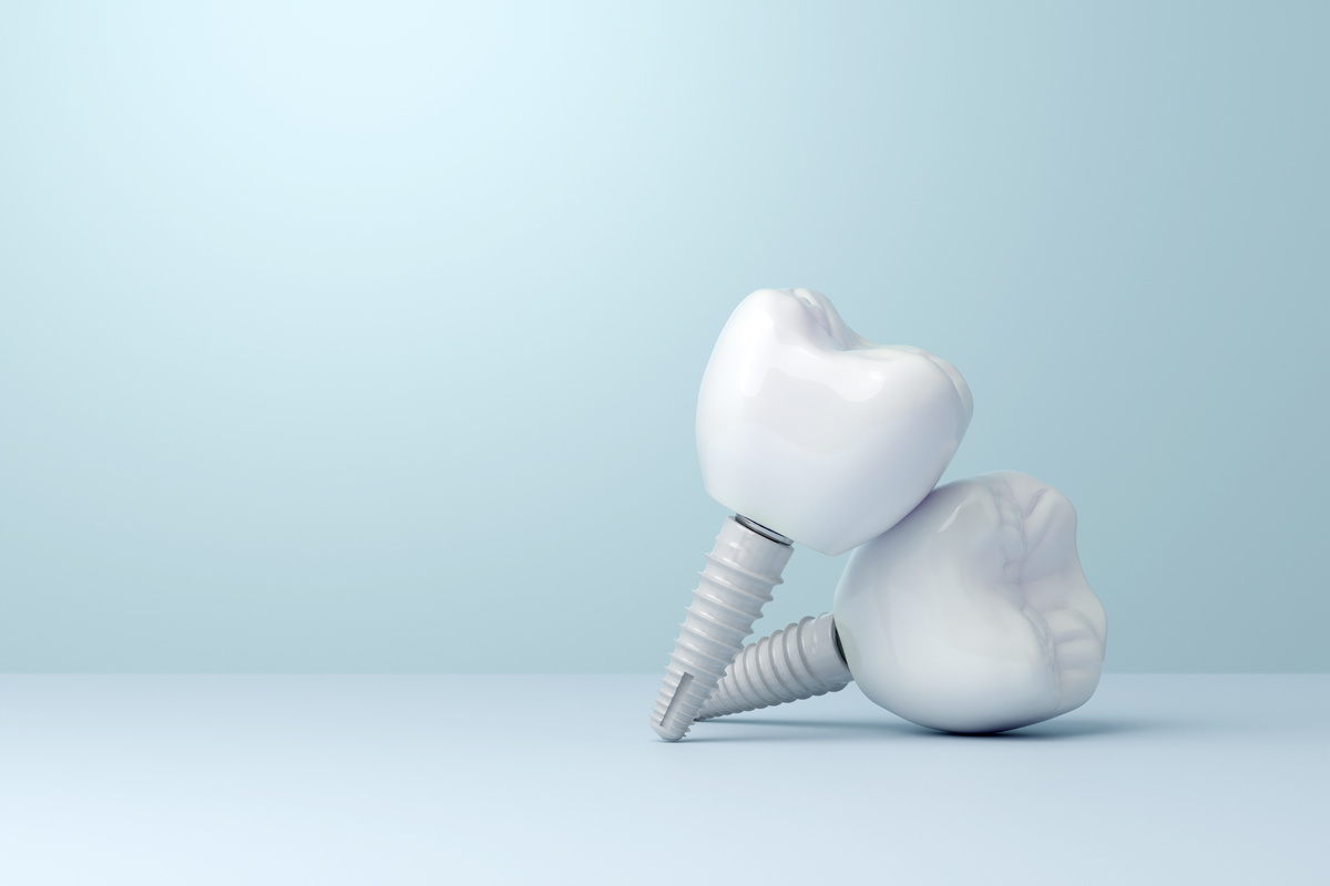 Zirconia dental implant with copy space on blue background. 3D rendering Zirconia dental implant with copy space on blue background. 3D rendering