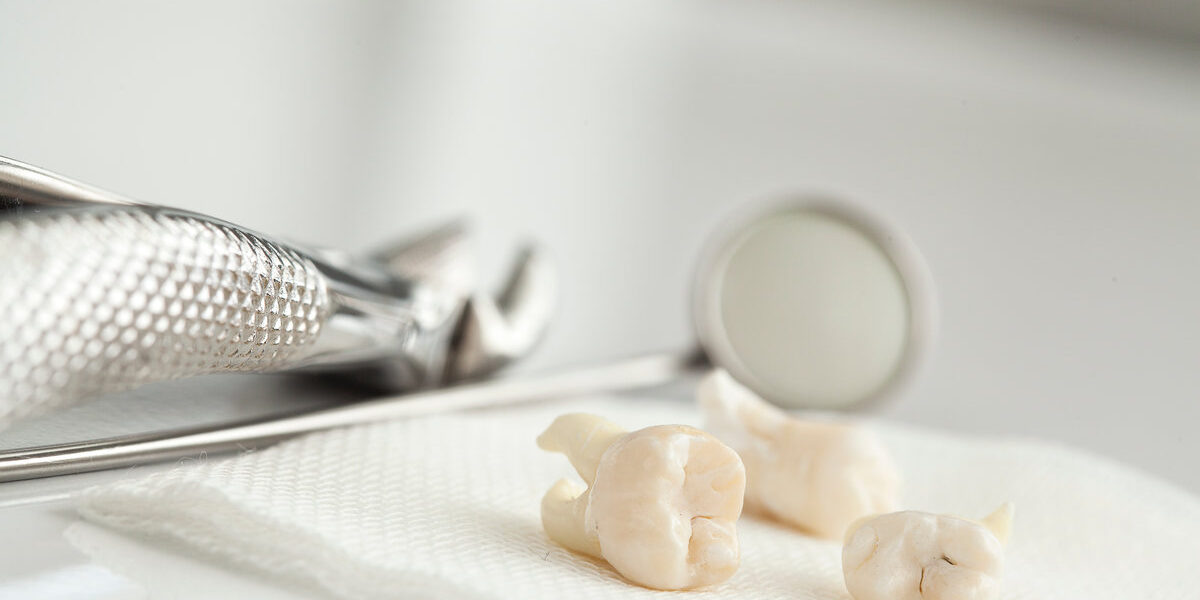 Removed wisdom tooth on white