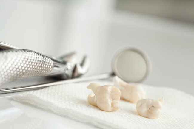 Removed wisdom tooth on white Removed wisdom tooth on white