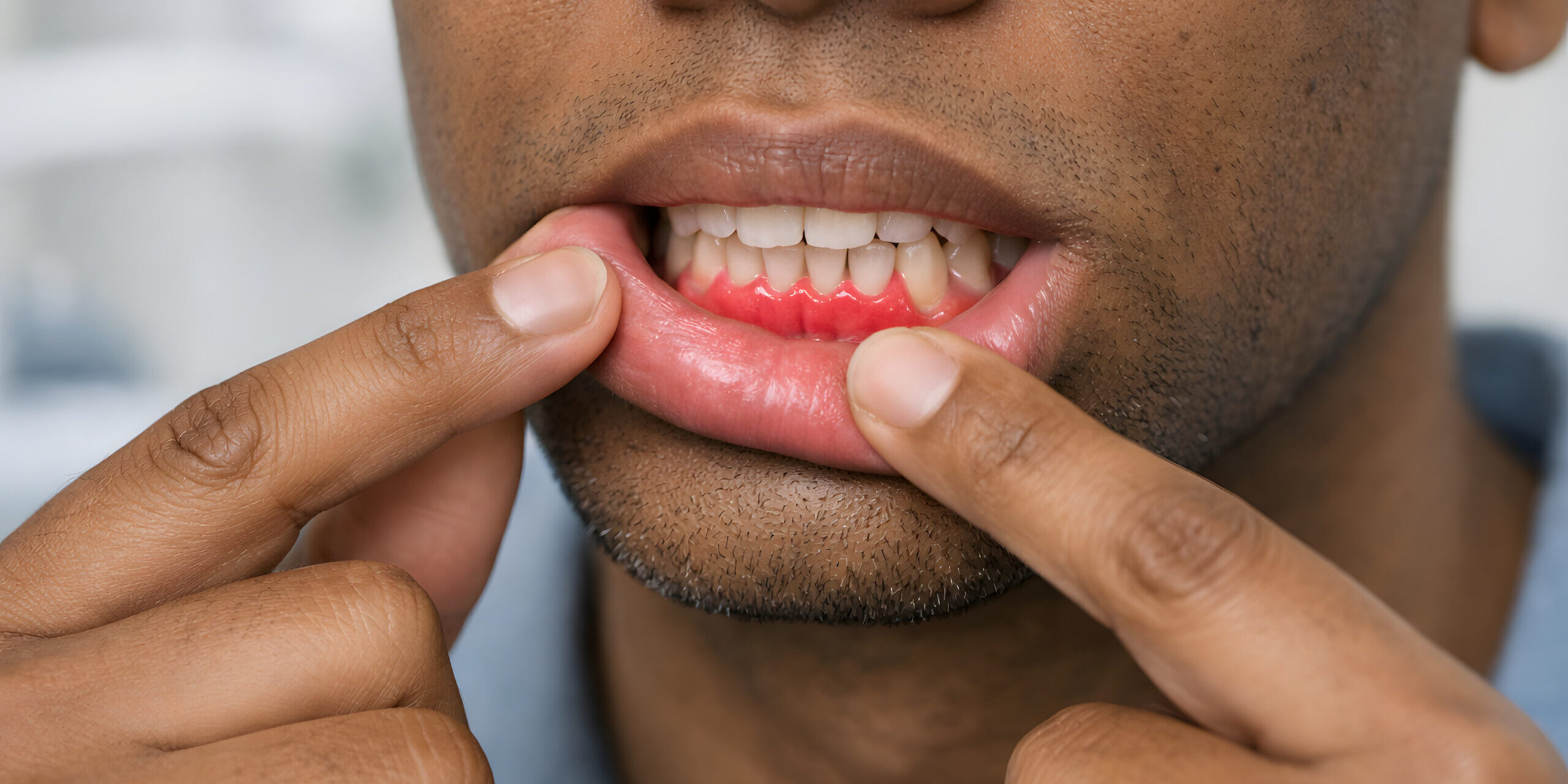 Patient Pointing at Red Gums in Dental Office, Periodontal Disease Concept Patient Pointing at Red Gums in Dental Office, Periodontal Disease Concept