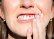 Woman filling pain because of bleeding gums. Periodontal disease, avitaminosis, gingivitis, scurvy. High quality photo