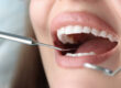 Dentist conducts medical examination of patient teeth. Dental clinic services concept