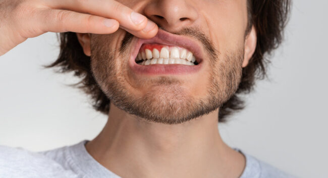 Handsome man touch mouth with hand, with painful expression of toothache